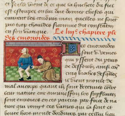 Ms 22532バルテルミーラングレによるLe Livre des Proprietes des chosesによる痔の患者の検査、c。 1410-15 作： French School