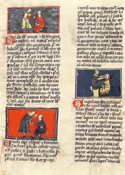 Ms H 89 fol.16v歯科手術、Rogier de Salerneによる「Book of Surgery」のエディションから 作： French School
