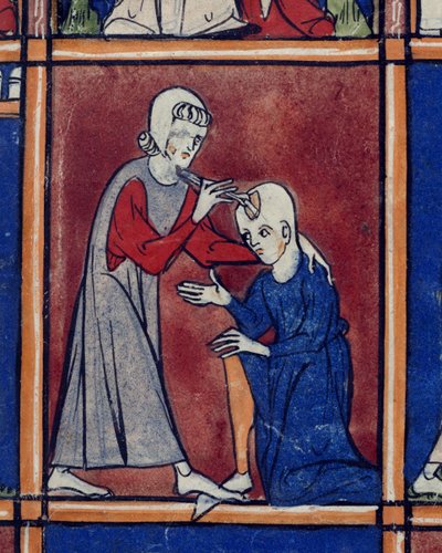Sloane 1977 f.2 患者の頭蓋骨の手術、「Chiurgia」のイラスト、パルマのロジャー フルガルディ作、c.1300-10 (ベラム) 作： French School