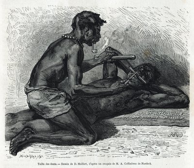 オカンダの歯の大きさ、アルフレッド・マルシェによる1875年から1877年のガボンとオゴエ川への旅の物語を説明するためのD.Maillardによる図面。Le tour du monde』に掲載されたエングレーヴィング 作： French School