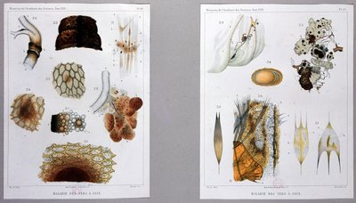 科学アカデミーでパスツールが発表した蚕の病気に関する研究。 作： French School