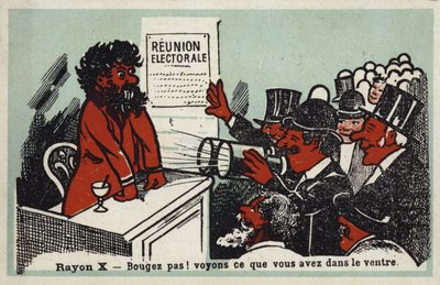 X線-移動しないでください！彼が彼の胃で得たものを見てみましょう 作： French School