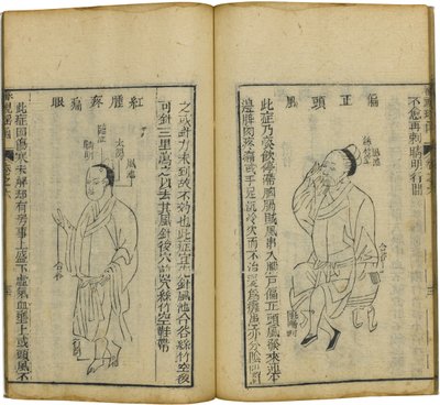 シェン・シー・ヤオ・ハン眼科の貴重な本、1644 作： Fu Renyu