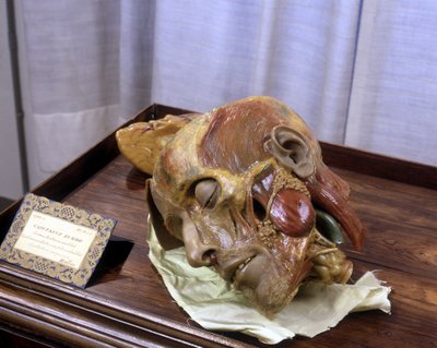 不明な画像 作： Gaetano Giulio Zumbo