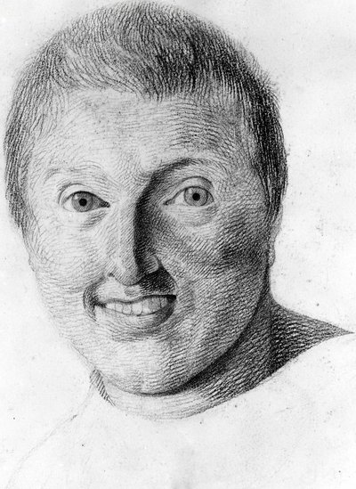 ガブリエルが描いた「異人の人相学の研究」に登場するてんかん患者。 作： Georges Francois Gabriel