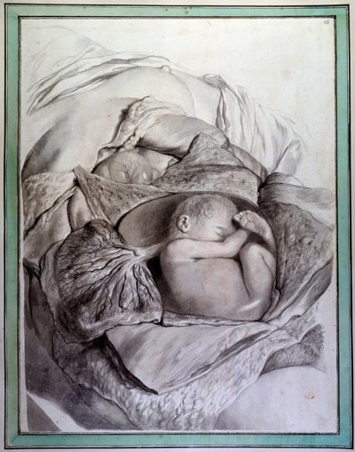 子宮の中にいる人間の胎児を表現したもの Govert Bidloo (or Govard) (1649-1713)の「Anatomia Humani Corporis」を図解したGerard de Lairesse (1640-1711)のエングレーヴィング 18世紀 パリの医学部付属図書館蔵 作： Gerard de Lairesse