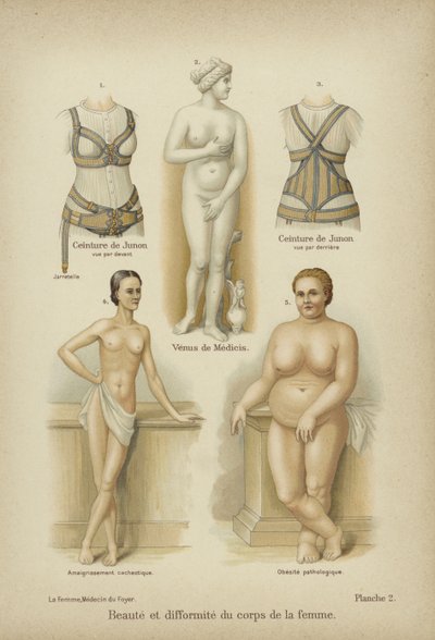女性の身体の美しさと奇形 作： German School