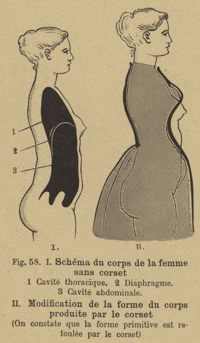 コルセットの着用が女性の体の形に与える影響を示す図 作： German School