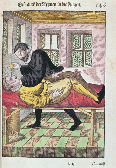 眼科手術、眼科、Georg Bartisch（1535-1636）、1583年にドレスデンで出版（色木版画） 作： German School