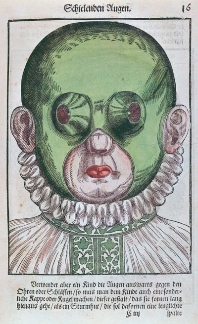 眼帯を治療するためのマスク。眼科治療用のマスクで、1583年にドレスデンで出版されたGeorg Bartisch（1535-1636）によるOcolourmodouleia（色の木版画） 作： German School