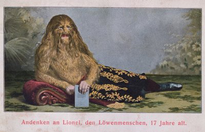 1909年17歳のライオンボーイ、ライオネルを描いたポストカード 作： German School