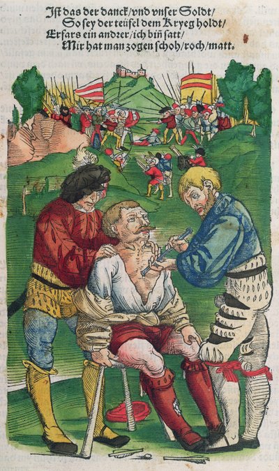 矢印を削除、ハンスフォンゲルスドルフ作「フェルトブッフデアヴンダルツニー」、1540年 作： German School