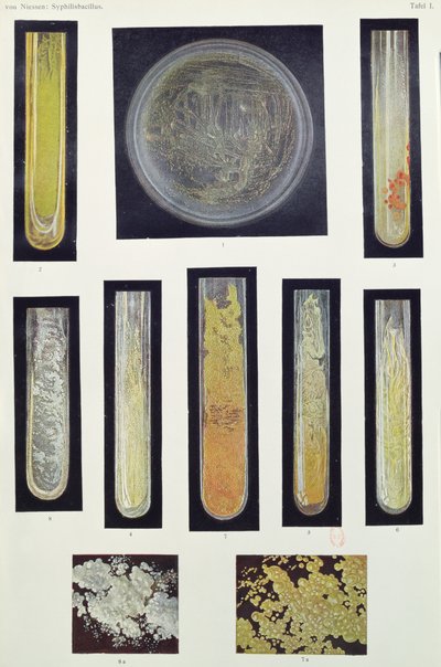 Syphilus Bacillus、マックスフォンニーセン著、ライプツィヒ、1908年 作： German School