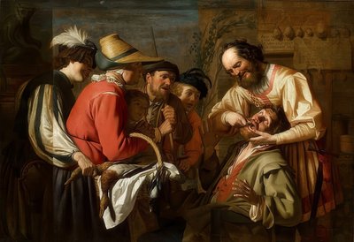 歯の引き手。 1628年（？） 作： Gerrit van Honthorst