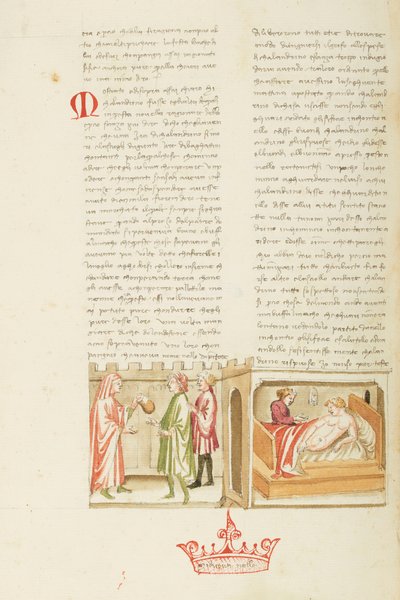 デカメロン、想像上の病人-想像上の病人カランドリーノ、9日目、短編3 作： Giovanni Boccaccio