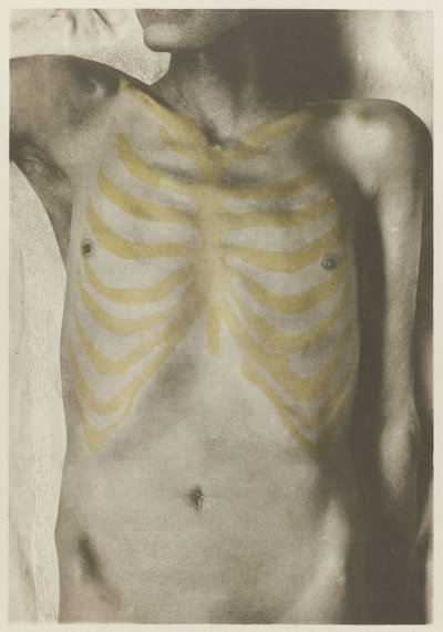 Anatomical foto van een mannelijk lijk: 