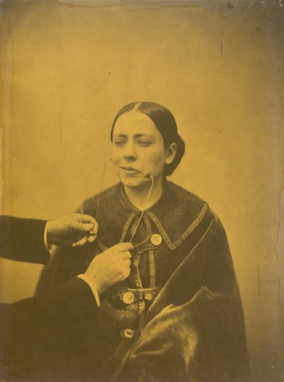 軽蔑的な嫌悪（左）、軽蔑的な笑い（右）、1854-1856年、1862年プリント（写真） 作： Guillaume-Benjamin-Armand Duchenne de Boulogne