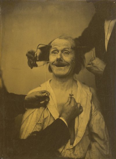快い驚きまたは賞賛の誤った、不完全な表現 作： Guillaume Benjamin Amant Duchenne