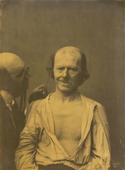 リラックスした顔（左）。 偽りの喜びまたは笑い (右) 作： Guillaume Benjamin Amant Duchenne