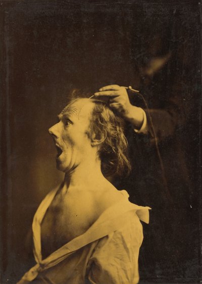 驚愕・驚愕・驚愕 作： Guillaume Benjamin Amant Duchenne