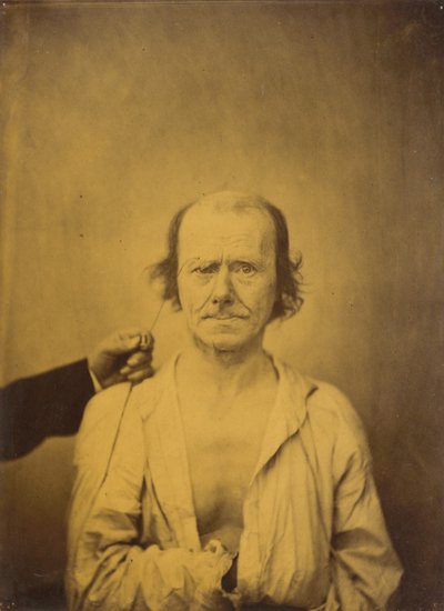 注意（左）; 反射（右） 作： Guillaume Benjamin Amant Duchenne