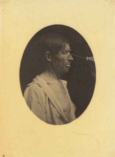 機嫌の悪さ、不満 作： Guillaume Benjamin Amant Duchenne
