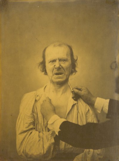 不満、悪いユーモア 作： Guillaume Benjamin Amant Duchenne