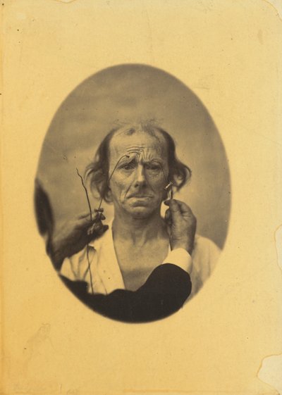 不満、憂鬱な考え (左); 反射（右） 作： Guillaume Benjamin Amant Duchenne