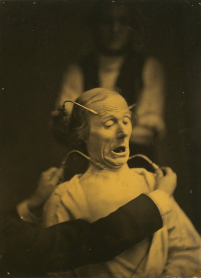 恐怖の表現 作： Guillaume Benjamin Amant Duchenne