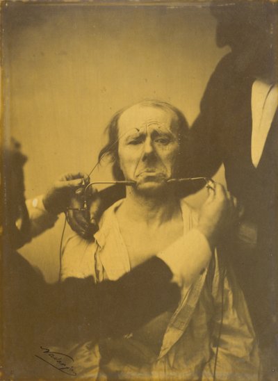 痛みと絶望 作： Guillaume Benjamin Amant Duchenne