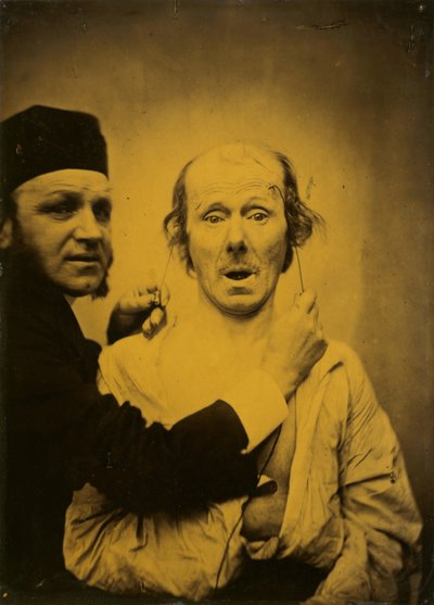 サプライズ 作： Guillaume Benjamin Amant Duchenne