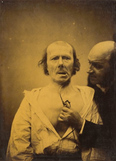 この m の短縮。 広汎性症候群だけでは発現がありません 作： Guillaume Benjamin Amant Duchenne