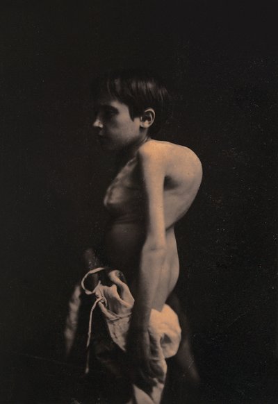 ゆったりとした少年の肖像、1855-57年 作： Guillaume Benjamin Armand Duchenne de Boulogne