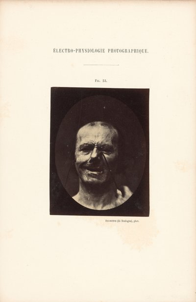 写真電気生理学、図53 作： Guillaume Benjamin Duchenne