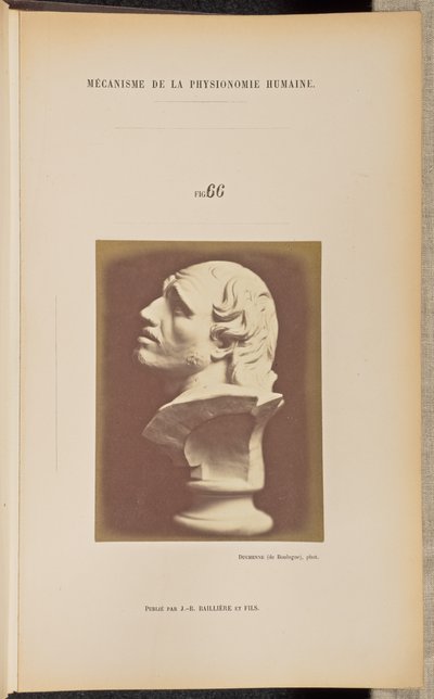図66 作： Guillaume Benjamin Duchenne