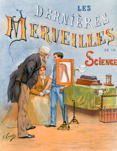 レントゲン写真による子供の腕の検査、19 世紀 作： Gustave Francois Lasellaz