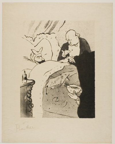 カルノーは病気です！ 作： Henri de Toulouse Lautrec