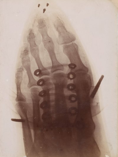 靴の中の足、1896 年。 作： Henri van Heurck