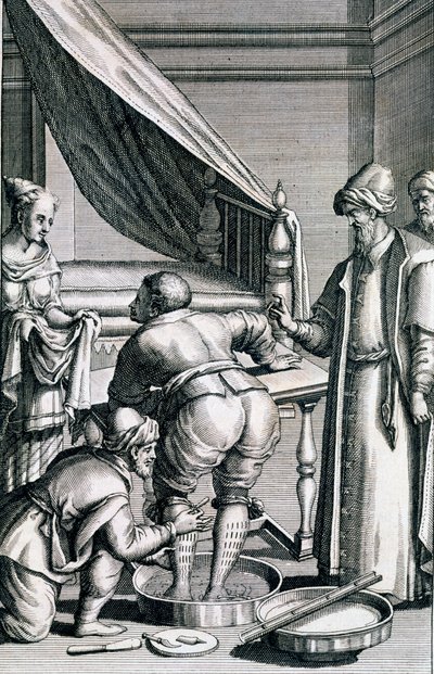 1745年に出版されたProspero AlpiniによるMedicina Aegyptiorumからの脚の流血 作： Italian School