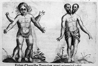 さまざまな種類の人間の怪物 イタリアの科学者Fortunio Liceti（1577-1656）の「De monstrorum natura, causis et differentiis」からの版画。1646 作： Italian School