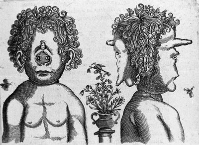 異なるタイプの人間の怪物：顔と怪物の頭の顔。イタリアの科学者Fortunio Liceti(1577-1656)の「De monstrorum natura, causis et differentiis」からのエングレーヴィング。1646 作： Italian School