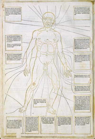 「Fassiculus Medicinae」ベニスのイラスト 作： Italian School
