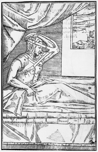 鼻の再建手術、Gaspare Tagliacozzi（1545-99）Venice、1597年発行のInsitionemによるDe curtorum chirurgiaのイラスト、1597年発行 作： Italian School