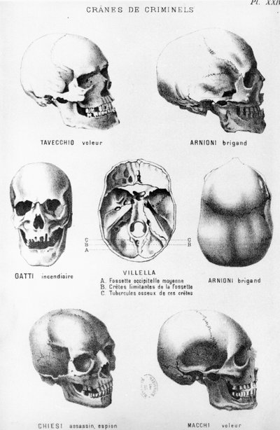 殺人者の頭蓋骨、チェザーレロンブロソによるLHommeクリミネル（1835-1909）、フェリックスアルカン発行、1887年 作： Italian School