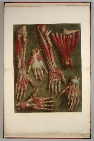 切開した手のグループ、1745-46 作： Jacques Fabien Gautier dAgoty