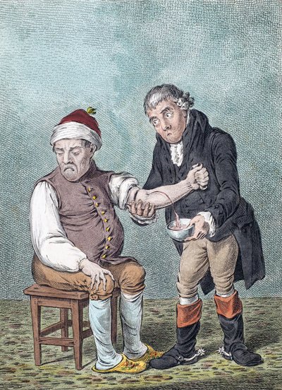 瀉血。瀉血(プリント） 作： James (after) Gillray