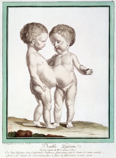 シャムの子供たち - レグノーの「自然の逸脱」にて 作： Jean Baptiste Regnault