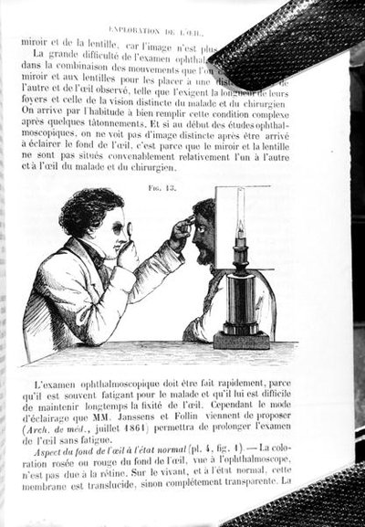 トーマス・ウォートン・ジョーンズ（1808-91）の「眼科医学および外科学の原理と実践に関するマニュアル」をE.フーシェが翻訳した「Traite Pratique des Maladies des Yeux」の図版（1862年にパリで出版）（彫刻）（モノクロ写真）。 作： Jean Francois Badoureau