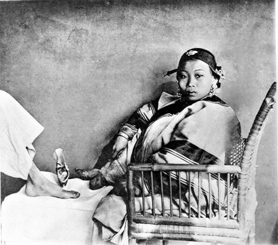 ヨーロッパ人の足の隣で、伝統的な靴を履いて切断された足を見せる女性（写真 作： John Thomson