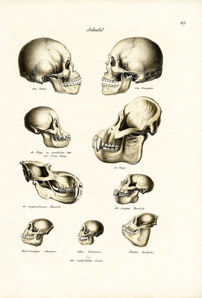 人間の頭蓋骨、1824 作： Karl Joseph Brodtmann